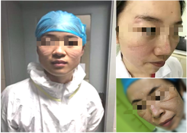 勒痕_副本02.png 勒痕_副本02.png